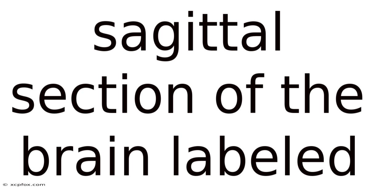 Sagittal Section Of The Brain Labeled