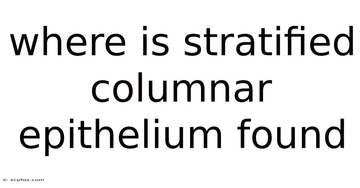 Where Is Stratified Columnar Epithelium Found